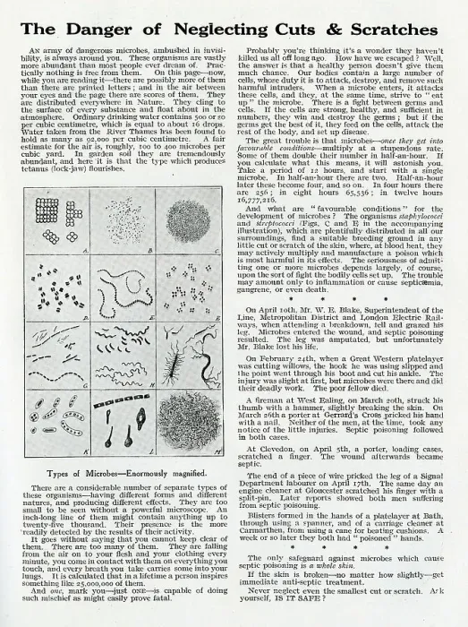 Framed Print : GWR Magazine article about cuts and scratches, June 1919 Framed Print : GWR Magazine article about cuts and scratches, June 1919